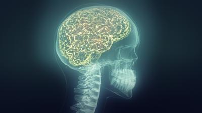 brain xray