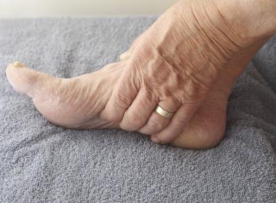 Painful swelling seems to effect lupus patients.