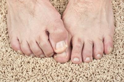 Feet