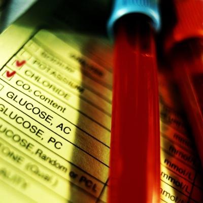 Glucose levels next to a blood vial.