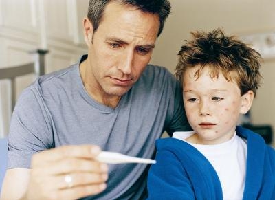 father with son who has chicken pox