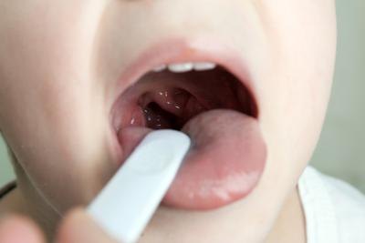 Child with swollen tonsils