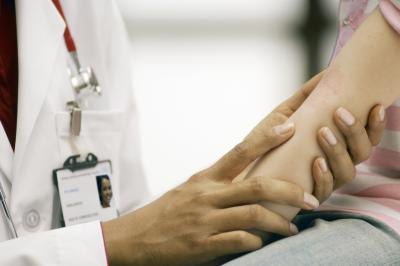 Doctor looking at bites
