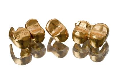 Gold dental crowns
