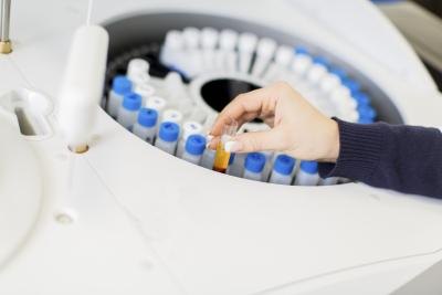Autoimmune diseases can cause a high RF lab result.