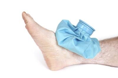 Avoid placing ice directly on burning feet.
