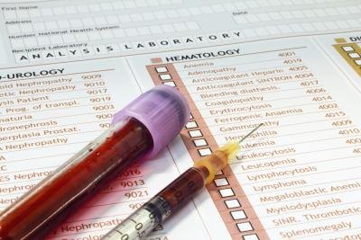 Extremely high RF results can indicate Sjogren's syndrome.