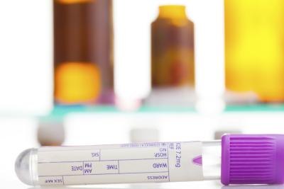 Blood is collected, and tested in a lab for RF.