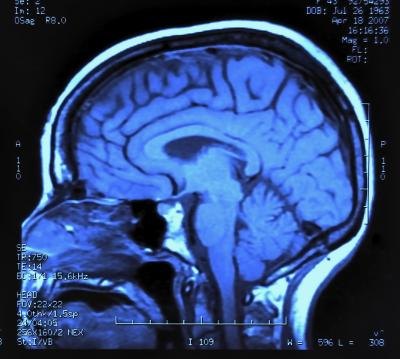 Scan of the human brain.