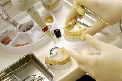 Dentist taking mold of teeth