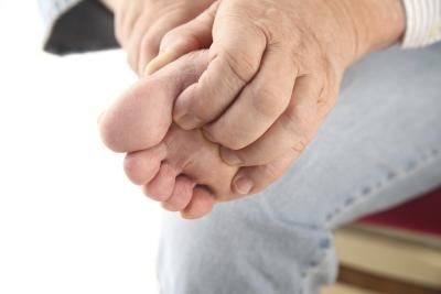 Itchy foot.