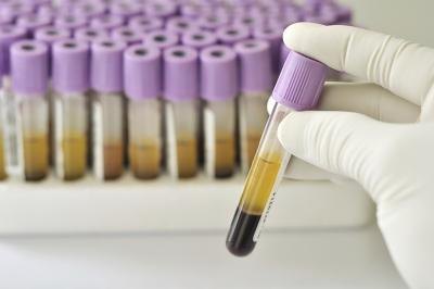 You don't have to go to the doctor's office to get your estrogen levels tested.