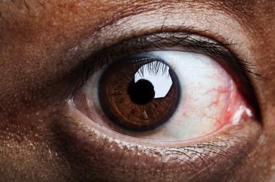Close up of red eye.