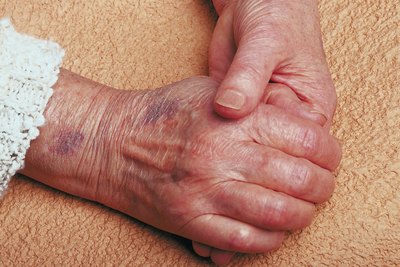 Elderly woman's hands