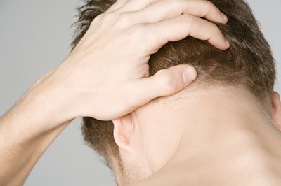 Notice skin reaction.