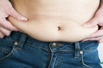 Loose skin
