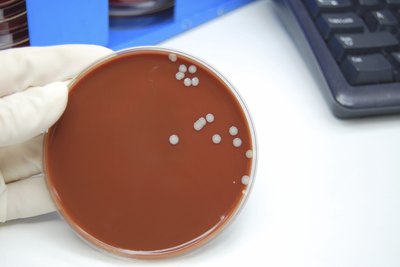 Microbiologist with staph infection.