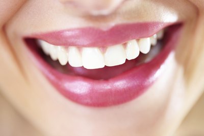 The formula you're using on your teeth is a type of acid.
