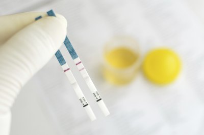 Urine tests are conducted to obtain different types of information.