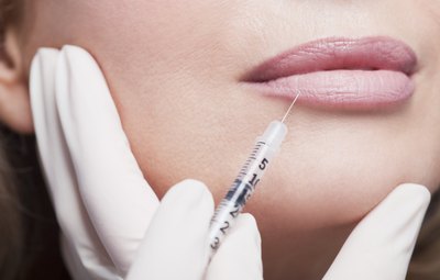 How to Treat Hematoma & Swelling After Botox