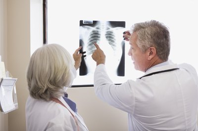 Doctors examine the chest x-ray of a patient.