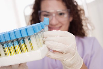 No fasting is required for hormone tests that test the levels of binding globulin, follicle stimulating or luteinizing hormone.