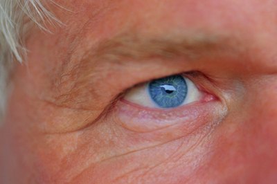 Senior eyes