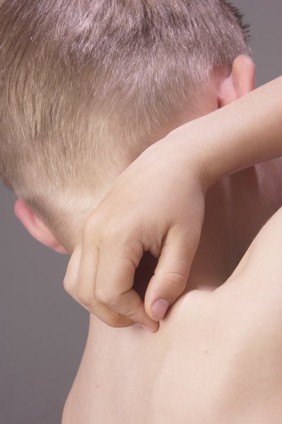 Little kid scratching his skin