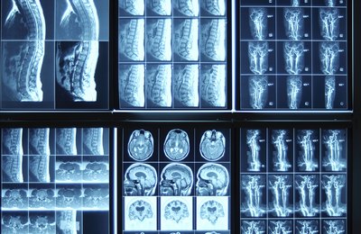 X-rays have advantages and disadvantages.