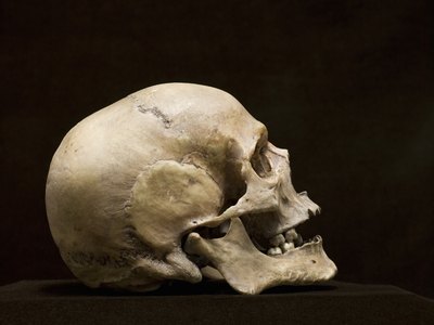 Skull