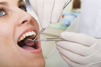 VA Dental Benefits