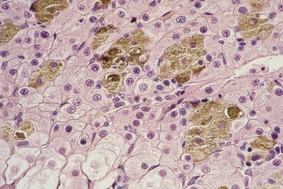 Liver section magnified 200 times