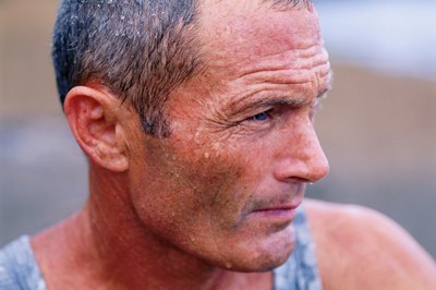 Sweating often accompanies gallstone pain