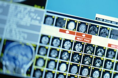X-ray of skulls