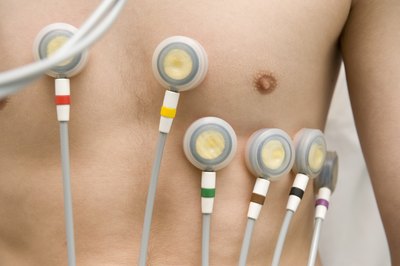man hooked up to EKG machine