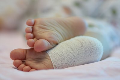 Woman getting resting after surgery