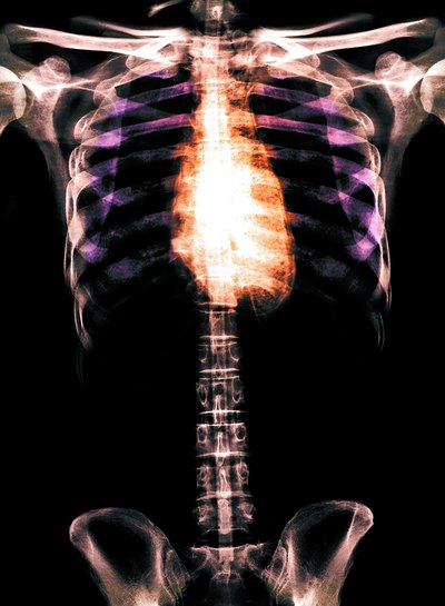 L-lysine helps the body form collagen, which is necessary for healthy bones, tendons, cartilage and skin
