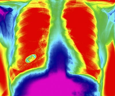 Closeup of a chest scan