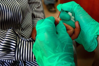 Hemoglobin test in a mobile clinic