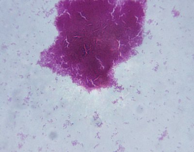 Microscopic image of bacteria.