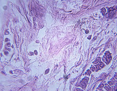 Infected cells