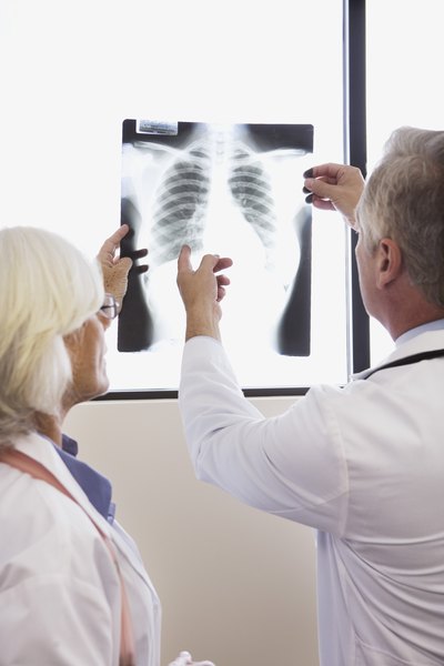 Doctors looking at XRay