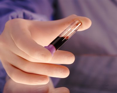 Blood tests also count the amount of platelets.