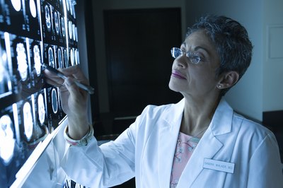 Doctor looking at brain scan