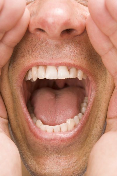 Man yelling