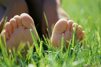 Sweaty feet are largely due to genetics.