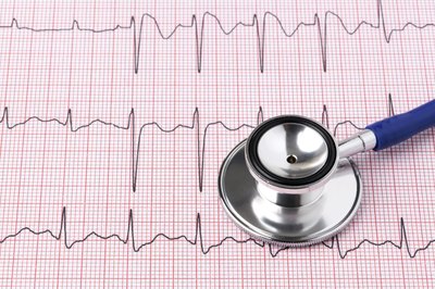 Electrocardiogram and stethoscope