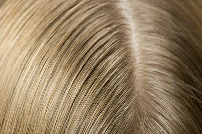 Close up of scalp.