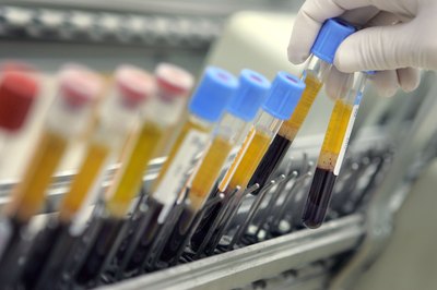 Human blood samples