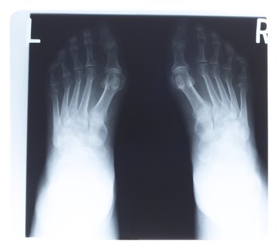 Toes bones of the foot.